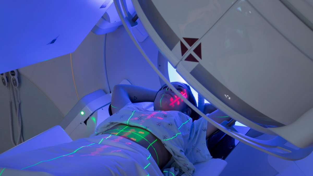 Radioterapia moderna: menos miedo, más precisión