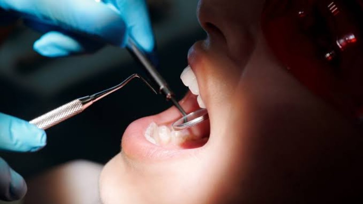 Fiscalía pide prisión por dentista ilegal que dejó lesiones permanentes